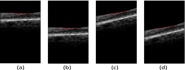 Figure 3 for Simultaneous Multiple Surface Segmentation Using Deep Learning