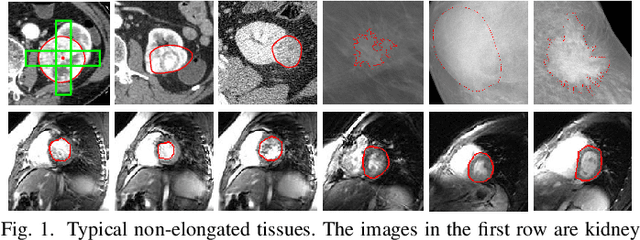 Figure 1 for Crossover-Net: Leveraging the Vertical-Horizontal Crossover Relation for Robust Segmentation