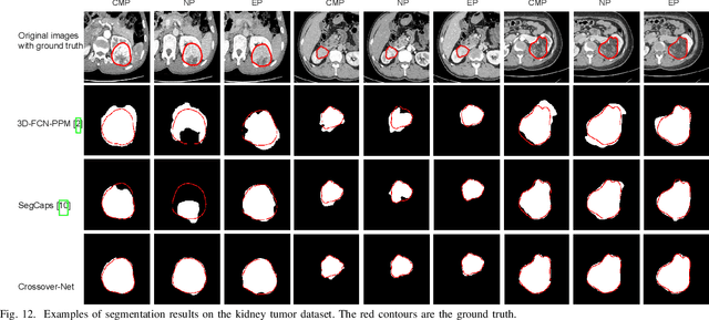Figure 4 for Crossover-Net: Leveraging the Vertical-Horizontal Crossover Relation for Robust Segmentation