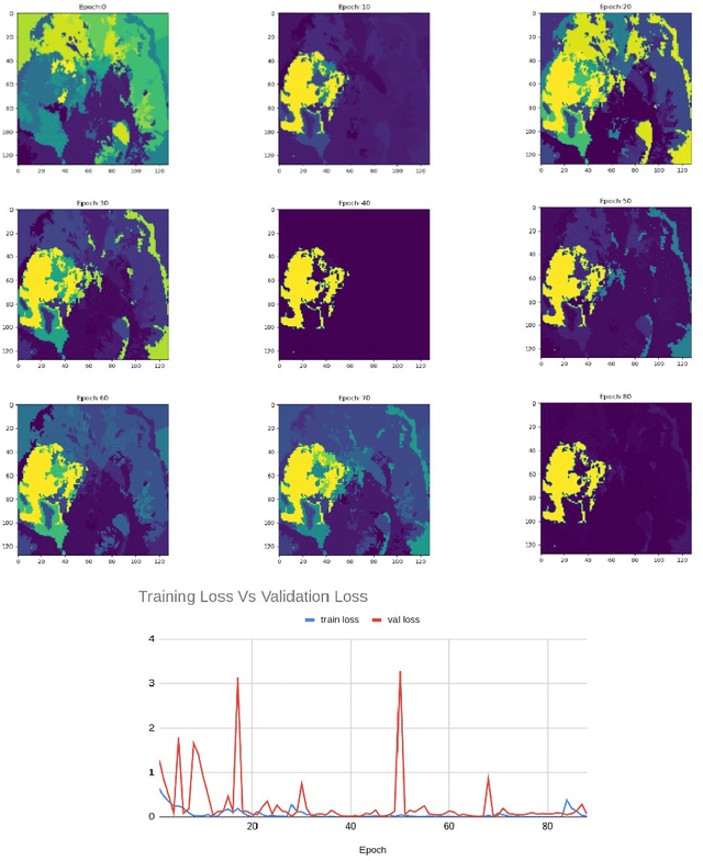 Figure 4 for Localized Perturbations For Weakly-Supervised Segmentation of Glioma Brain Tumours