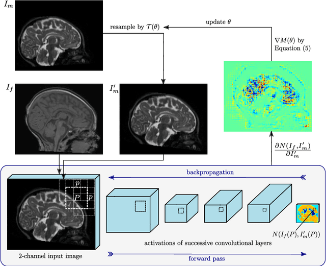 Figure 1 for A Deep Metric for Multimodal Registration