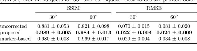 Figure 2 for Inertial Measurements for Motion Compensation in Weight-bearing Cone-beam CT of the Knee