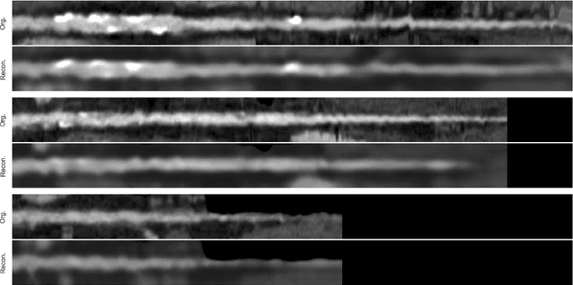 Figure 3 for Combined analysis of coronary arteries and the left ventricular myocardium in cardiac CT angiography for detection of patients with functionally significant stenosis