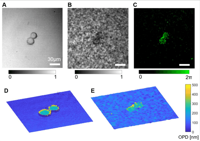 Figure 4 for Quantitative phase imaging through an ultra-thin lensless fiber endoscope