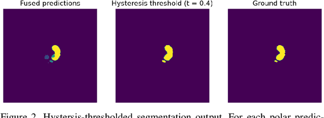 Figure 2 for Using the Polar Transform for Efficient Deep Learning-Based Aorta Segmentation in CTA Images