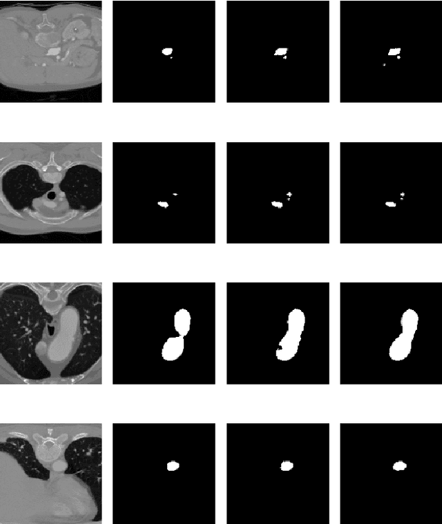 Figure 3 for Using the Polar Transform for Efficient Deep Learning-Based Aorta Segmentation in CTA Images