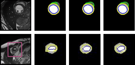 Figure 4 for A context based deep learning approach for unbalanced medical image segmentation
