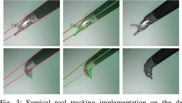 Figure 3 for SuPer: A Surgical Perception Framework for Endoscopic Tissue Manipulation with Surgical Robotics