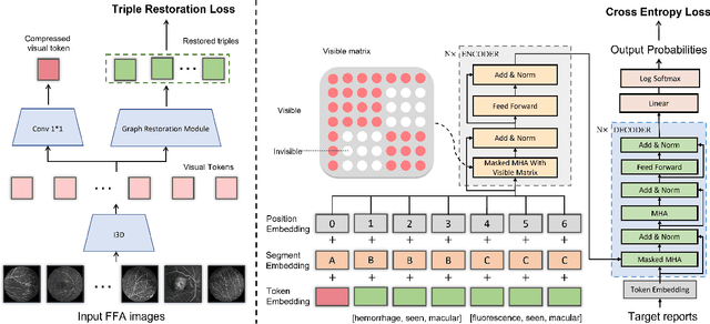 Figure 1 for Cross-modal Clinical Graph Transformer for Ophthalmic Report Generation