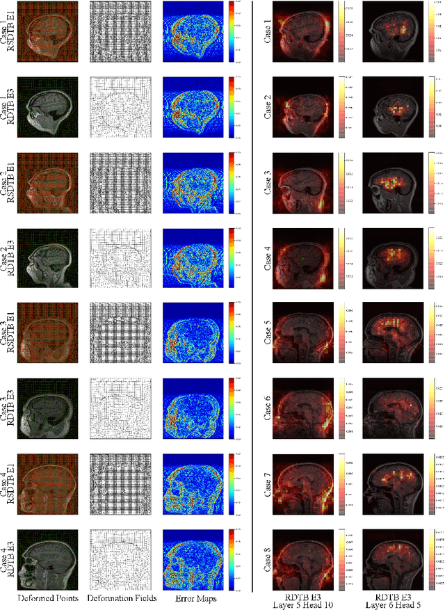 Figure 4 for Swin Deformable Attention U-Net Transformer (SDAUT) for Explainable Fast MRI