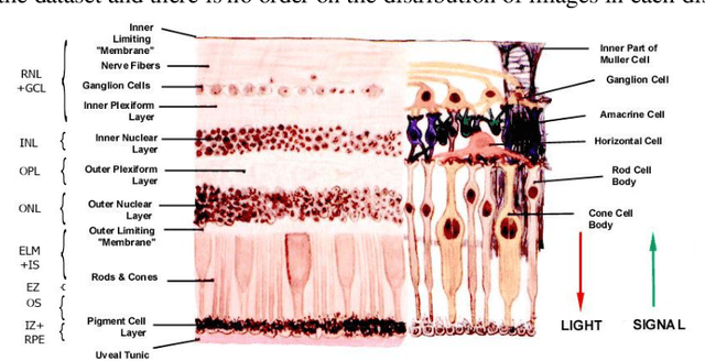 Figure 1 for OCTID: Optical Coherence Tomography Image Database