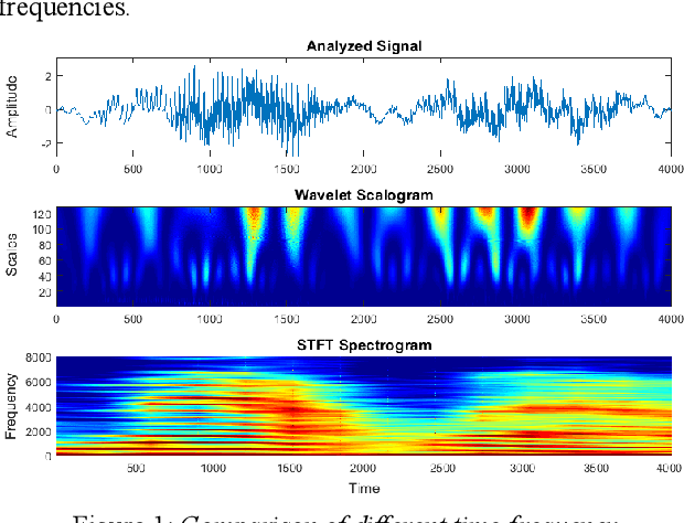 Figure 1 for Continuous Wavelet Vocoder-based Decomposition of Parametric Speech Waveform Synthesis