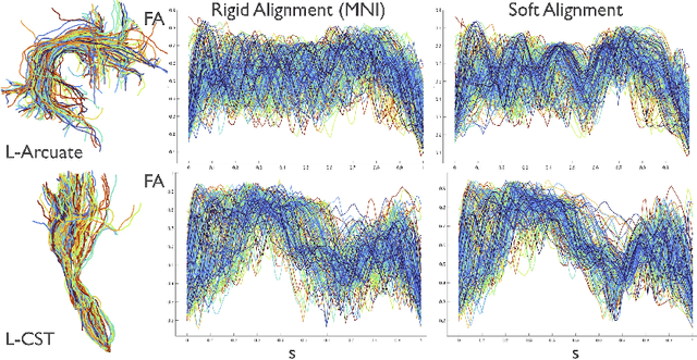 Figure 2 for Alignment of Tractography Streamlines using Deformation Transfer via Parallel Transport