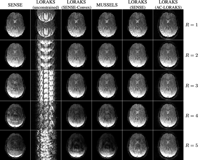 Figure 4 for Navigator-free EPI Ghost Correction with Structured Low-Rank Matrix Models: New Theory and Methods