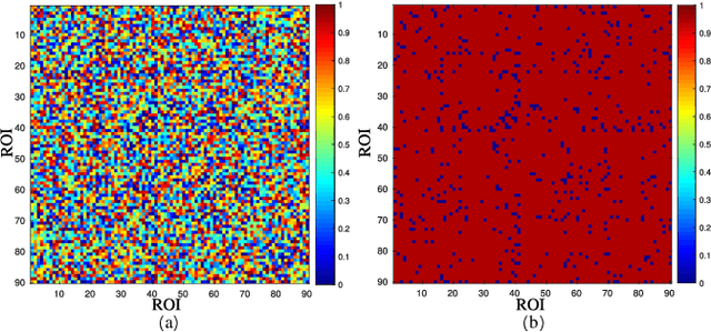Figure 3 for A Prior Guided Adversarial Representation Learning and Hypergraph Perceptual Network for Predicting Abnormal Connections of Alzheimer's Disease