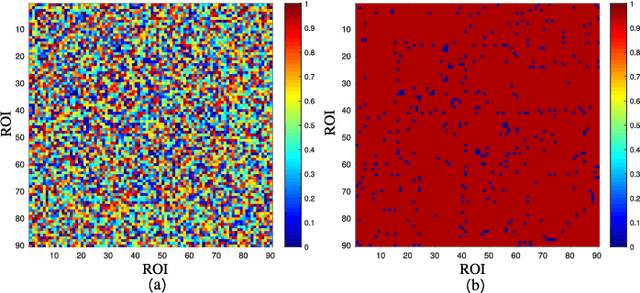 Figure 4 for A Prior Guided Adversarial Representation Learning and Hypergraph Perceptual Network for Predicting Abnormal Connections of Alzheimer's Disease