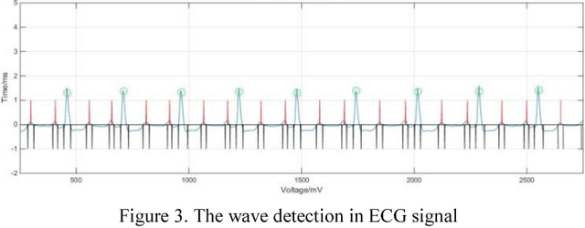 Figure 3 for ECG beats classification via online sparse dictionary and time pyramid matching