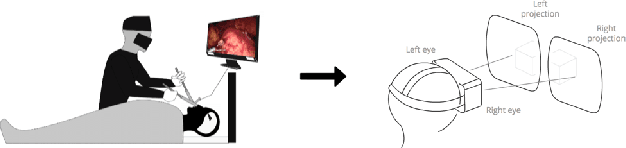 Figure 1 for Stereo Video Reconstruction Without Explicit Depth Maps for Endoscopic Surgery