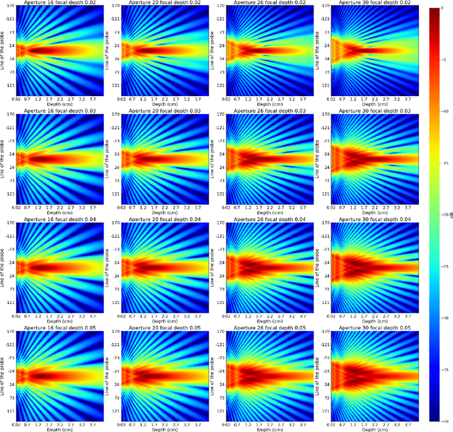 Figure 3 for Narrowband Transmit Beam Pattern in medical ultrasound: a stochastic approach to delays optimization