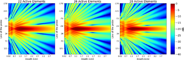 Figure 4 for Narrowband Transmit Beam Pattern in medical ultrasound: a stochastic approach to delays optimization