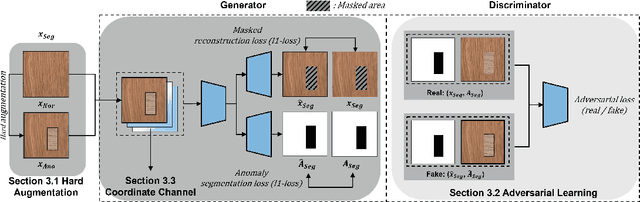 Figure 3 for AnoSeg: Anomaly Segmentation Network Using Self-Supervised Learning