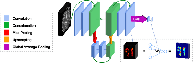 Figure 1 for When Weak Becomes Strong: Robust Quantification of White Matter Hyperintensities in Brain MRI scans
