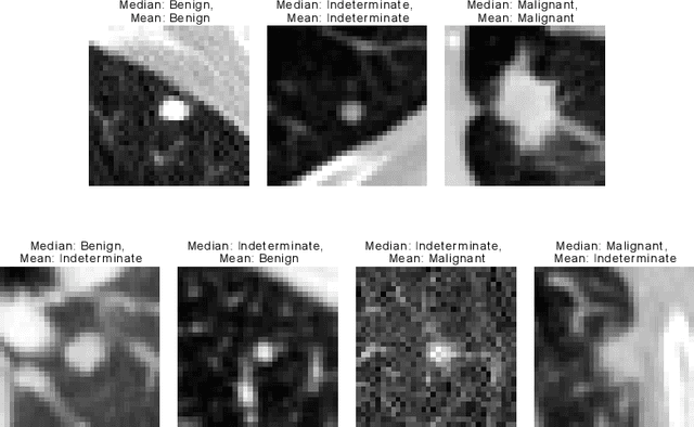 Figure 1 for The Pitfalls of Sample Selection: A Case Study on Lung Nodule Classification