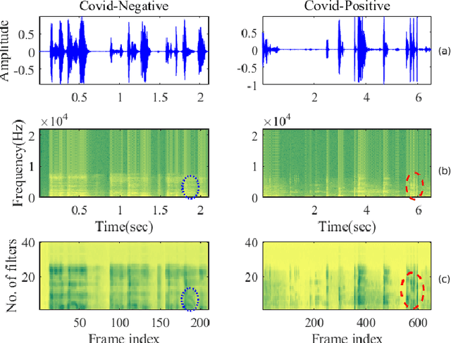 Figure 3 for PANACEA cough sound-based diagnosis of COVID-19 for the DiCOVA 2021 Challenge