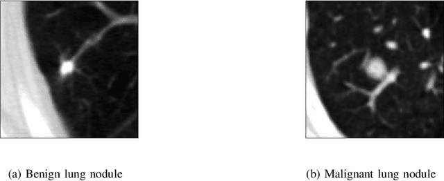 Figure 1 for Quantum-classical convolutional neural networks in radiological image classification