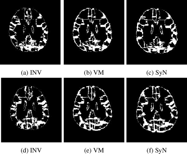 Figure 3 for A Multiple Decoder CNN for Inverse Consistent 3D Image Registration