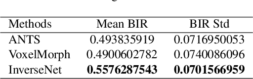 Figure 2 for A Multiple Decoder CNN for Inverse Consistent 3D Image Registration