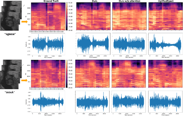 Figure 3 for Tagged-MRI Sequence to Audio Synthesis via Self Residual Attention Guided Heterogeneous Translator