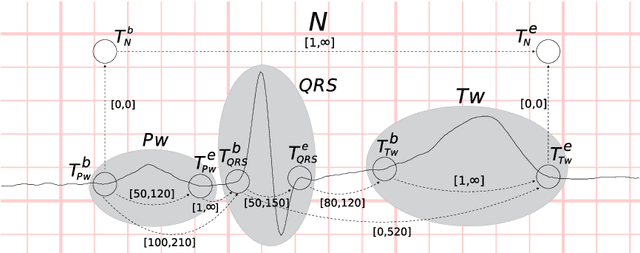 Figure 1 for Construe: a software solution for the explanation-based interpretation of time series