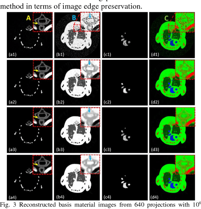 Figure 3 for Block Matching Frame based Material Reconstruction for Spectral CT