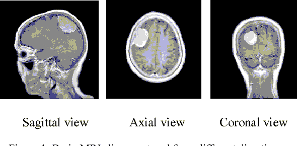 Figure 1 for Brain Tumor Segmentation Using Deep Learning by Type Specific Sorting of Images