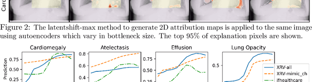 Figure 3 for Gifsplanation via Latent Shift: A Simple Autoencoder Approach to Progressive Exaggeration on Chest X-rays