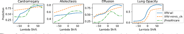 Figure 4 for Gifsplanation via Latent Shift: A Simple Autoencoder Approach to Progressive Exaggeration on Chest X-rays