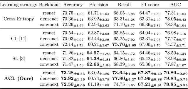 Figure 4 for Less is More: Adaptive Curriculum Learning for Thyroid Nodule Diagnosis