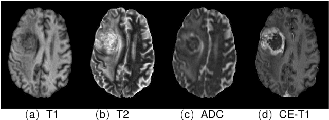 Figure 1 for Synthesizing MR Image Contrast Enhancement Using 3D High-resolution ConvNets