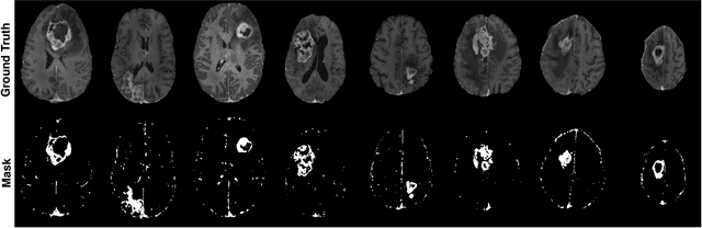 Figure 3 for Synthesizing MR Image Contrast Enhancement Using 3D High-resolution ConvNets