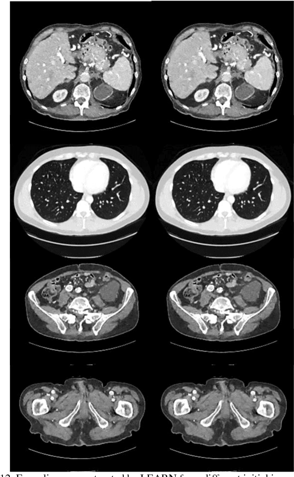 Figure 3 for LEARN: Learned Experts' Assessment-based Reconstruction Network for Sparse-data CT