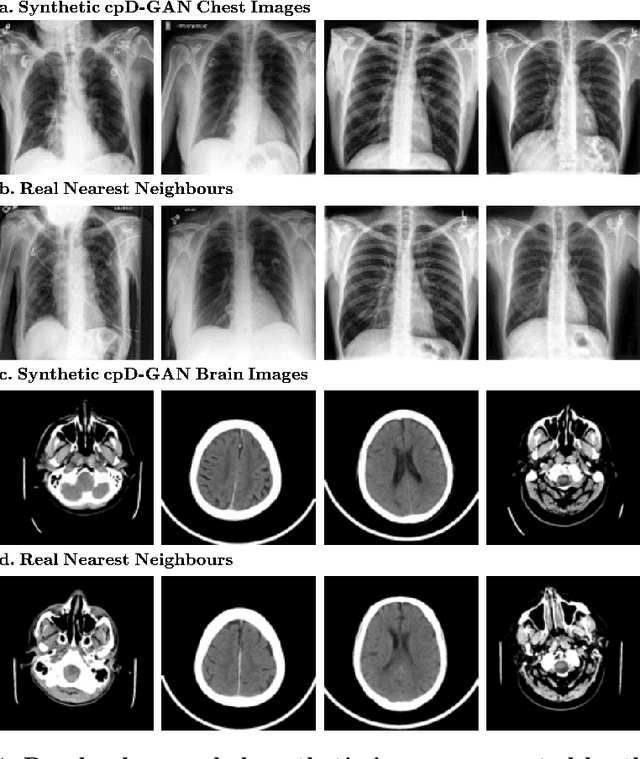 Figure 4 for Overcoming Barriers to Data Sharing with Medical Image Generation: A Comprehensive Evaluation