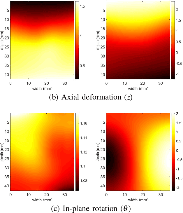 Figure 1 for Fast Approximate Time-Delay Estimation in Ultrasound Elastography Using Principal Component Analysis
