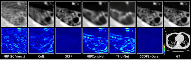 Figure 3 for Self-Supervised Coordinate Projection Network for Sparse-View Computed Tomography
