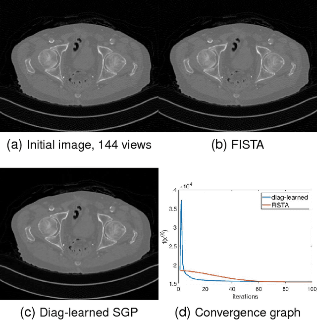 Figure 4 for Speeding up scaled gradient projection methods using deep neural networks for inverse problems in image processing