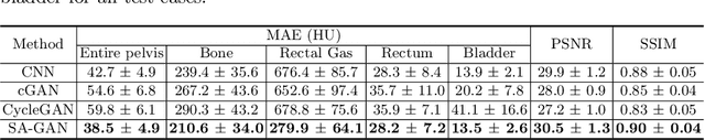 Figure 2 for SA-GAN: Structure-Aware Generative Adversarial Network for Shape-Preserving Synthetic CT Generation