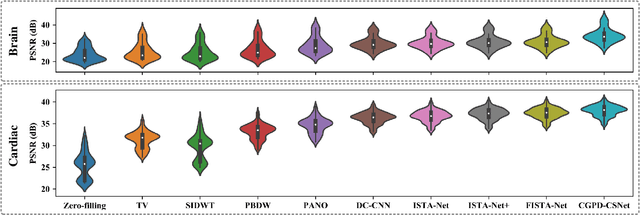 Figure 3 for A Unifying Multi-sampling-ratio CS-MRI Framework With Two-grid-cycle Correction and Geometric Prior Distillation