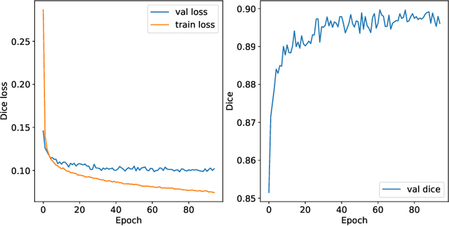 Figure 3 for Open-source tool for Airway Segmentation in Computed Tomography using 2.5D Modified EfficientDet: Contribution to the ATM22 Challenge