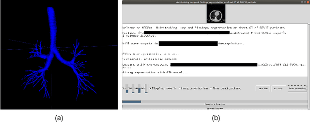 Figure 4 for Open-source tool for Airway Segmentation in Computed Tomography using 2.5D Modified EfficientDet: Contribution to the ATM22 Challenge
