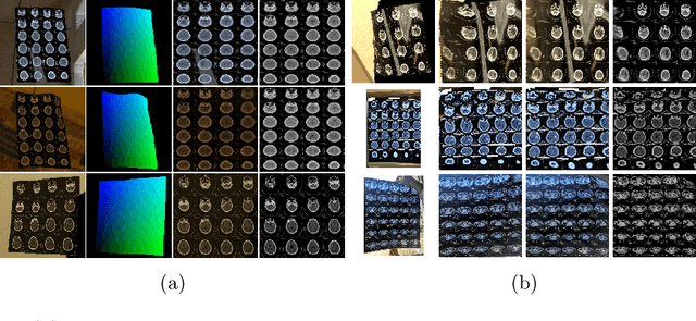 Figure 1 for Recovering medical images from CT film photos
